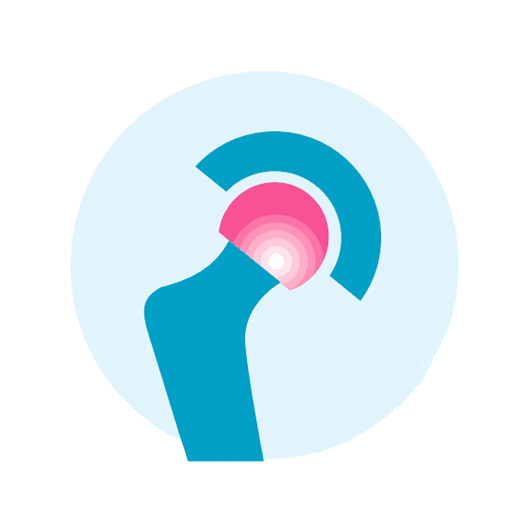 Fellowship en reemplazo articular UCIART