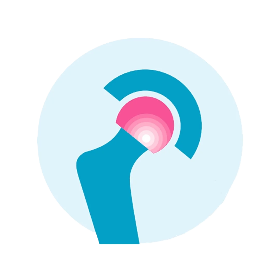 Fellowship en reemplazo articular UCIART